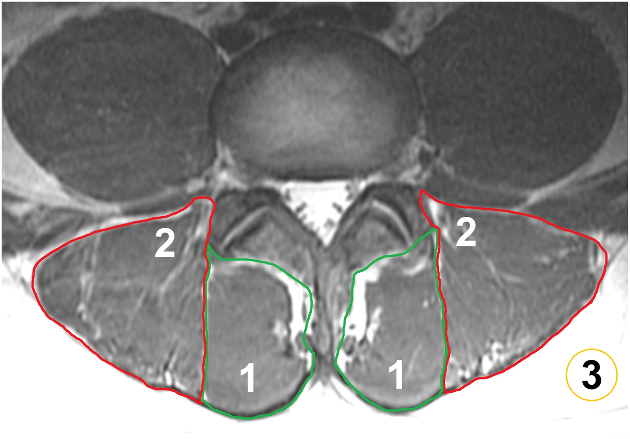jmri28145-fig-0003-m.jpg